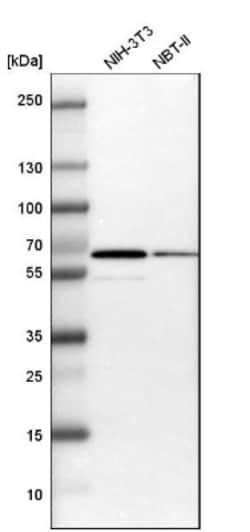 B4GALNT1 Antibody, Novus Biologicals:Antibodies:Primary Antibodies