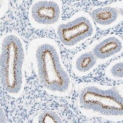 B4GALNT3 Antibody, Novus Biologicals 0.1mL; Unlabeled:Antibodies, Polyclonal