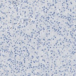 B4GALNT3 Antibody, Novus Biologicals 0.1mL; Unlabeled:Antibodies, Polyclonal