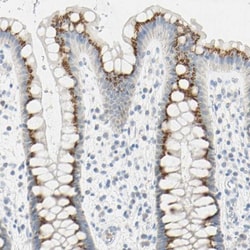 B4GALNT3 Antibody, Novus Biologicals 0.1mL; Unlabeled:Antibodies, Polyclonal