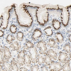 B4GALNT3 Antibody, Novus Biologicals 0.1mL; Unlabeled:Antibodies, Polyclonal