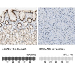 B4GALNT3 Antibody, Novus Biologicals 0.1mL; Unlabeled:Antibodies, Polyclonal