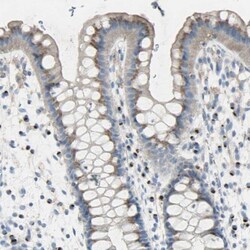 B4GALT3 Antibody, Novus Biologicals:Antibodies:Primary Antibodies