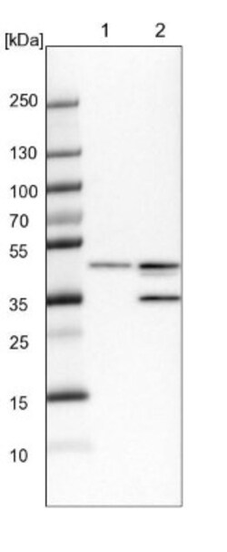 B4GALT3 Antibody, Novus Biologicals:Antibodies:Primary Antibodies