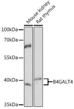 B4GALT4 Rabbit anti-Human, Mouse, Rat, Polyclonal, Novus Biologicals 100