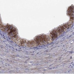 B4GALT7 Antibody, Novus Biologicals 25 &mu;L; Unlabeled:Antibodies, Polyclonal