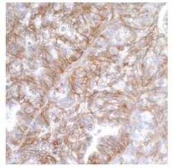 B7-H3/CD276 Antibody (BLR025F), Novus Biologicals 100 &mu;g; Unconjugated:Antibodies,