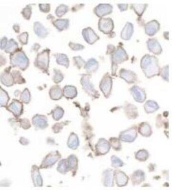 B7-H3/CD276 Antibody (BLR025F), Novus Biologicals 100 &mu;g; Unconjugated:Antibodies,