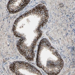 B7-H3/CD276 Antibody, Novus Biologicals:Antibodies:Primary Antibodies
