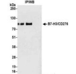 B7-H3/CD276 Antibody (BLR025F), Novus Biologicals 100 &mu;g; Unconjugated:Antibodies,