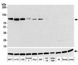 B7-H3/CD276 Antibody (BLR025F), Novus Biologicals 100 &mu;g; Unconjugated:Antibodies,