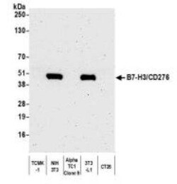 B7-H3/CD276 Antibody (BLR025F), Novus Biologicals 100 &mu;g; Unconjugated:Antibodies,