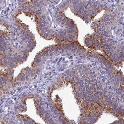 B9D2 Antibody, Novus Biologicals 0.1mL; Unlabeled:Antibodies, Polyclonal