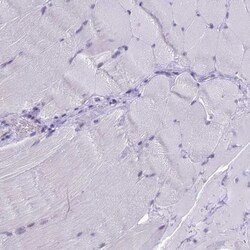B9D2 Antibody, Novus Biologicals 0.1mL; Unlabeled:Antibodies, Polyclonal