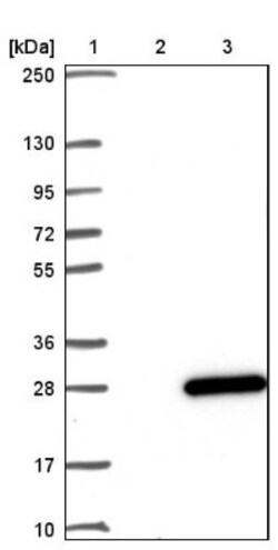 B9D2 Antibody, Novus Biologicals 0.1mL; Unlabeled:Antibodies, Polyclonal