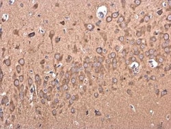 BACE-2 Antibody, Novus Biologicals 0.1mL; Unlabeled:Antibodies, Polyclonal