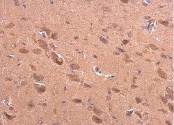 BACE-2 Antibody, Novus Biologicals 0.1mL; Unlabeled:Antibodies, Polyclonal