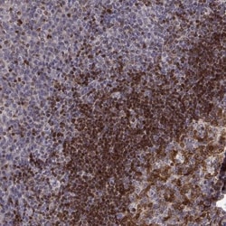 BACH2 Antibody, Novus Biologicals 0.1mL; Unlabeled:Antibodies, Polyclonal