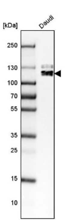 BACH2 Antibody, Novus Biologicals 0.1mL; Unlabeled:Antibodies, Polyclonal