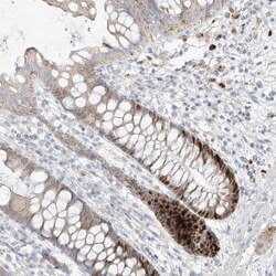 BAD-LAMP/LAMP5 Antibody, Novus Biologicals 0.1mL; Unlabeled:Antibodies,