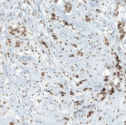 BAF180/PB1 Antibody (CL0331), Novus Biologicals 0.1mL; Unlabeled:Antibodies,