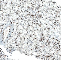 BAF180/PB1 Antibody (CL0331), Novus Biologicals 0.1mL; Unlabeled:Antibodies,