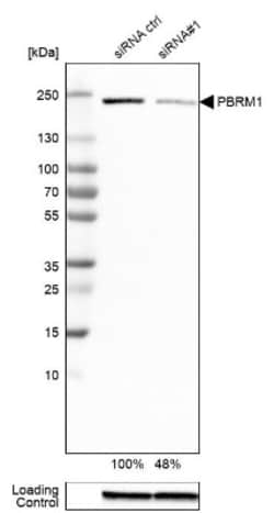 BAF180/PB1 Antibody (CL0331), Novus Biologicals 0.1mL; Unlabeled:Antibodies,
