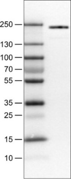 BAF180/PB1 Antibody (CL0331), Novus Biologicals 0.1mL; Unlabeled:Antibodies,