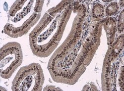 BAF180/PB1 Antibody, Novus Biologicals 0.1mg; Unlabeled:Antibodies, Polyclonal