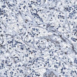 BAF180/PB1 Antibody, Novus Biologicals:Antibodies:Primary Antibodies