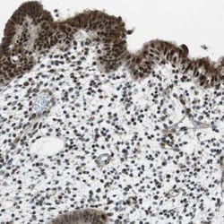 BAF180/PB1 Antibody, Novus Biologicals:Antibodies:Primary Antibodies