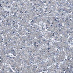 BAF180/PB1 Antibody, Novus Biologicals:Antibodies:Primary Antibodies