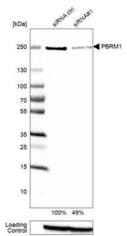 BAF180/PB1 Antibody, Novus Biologicals:Antibodies:Primary Antibodies