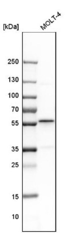 BAF57 Antibody, Novus Biologicals 25 &mu;L | Buy Online | Novus Biologicals | Fisher Scientific
