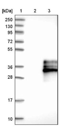 BAFFR/TNFRSF13C Antibody, Novus Biologicals 25 &mu;L; Unlabeled:Antibodies,