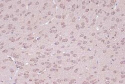 BAG2 Rabbit anti-Human, Mouse, Rat, Clone: 6D6Z0, Novus Biologicals 20