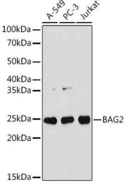 BAG2 Rabbit anti-Human, Mouse, Rat, Clone: 6D6Z0, Novus Biologicals 20