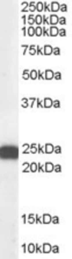 BAG2 Antibody, Novus Biologicals 0.1mg; Unlabeled:Antibodies, Polyclonal