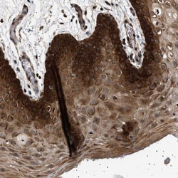 BAG3 Antibody, Novus Biologicals 0.1mL; Unlabeled:Antibodies, Polyclonal