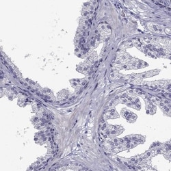 BAG5 Antibody, Novus Biologicals:Antibodies:Primary Antibodies