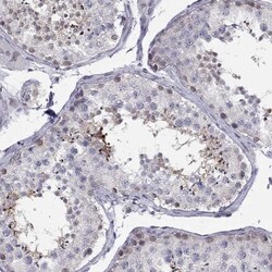 BAG5 Antibody, Novus Biologicals:Antibodies:Primary Antibodies