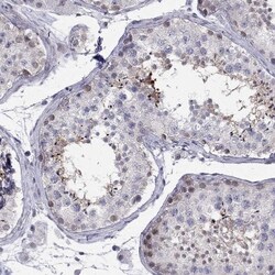 BAG5 Antibody, Novus Biologicals:Antibodies:Primary Antibodies