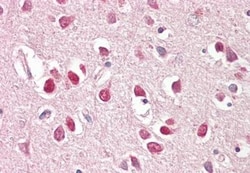 BAIAP2 Antibody, Novus Biologicals 0.1mg; Unlabeled:Antibodies, Polyclonal