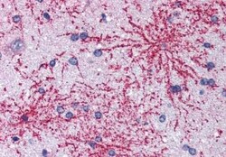BAIAP2 Antibody, Novus Biologicals 0.1mg; Unlabeled:Antibodies, Polyclonal