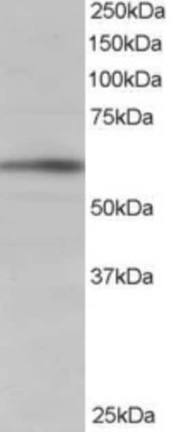 BAIAP2 Antibody, Novus Biologicals 0.1mg; Unlabeled:Antibodies, Polyclonal