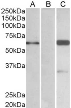BAIAP2 Antibody, Novus Biologicals 0.1mg; Unlabeled:Antibodies, Polyclonal