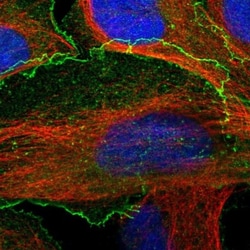 BAIAP2L1 Antibody, Novus Biologicals 25 &mu;L; Unlabeled:Antibodies, Polyclonal