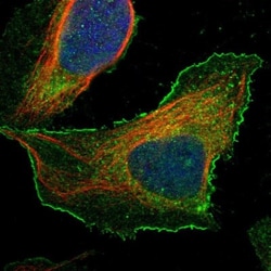 BAIAP2L1 Antibody, Novus Biologicals 0.1mL; Unlabeled:Antibodies, Polyclonal