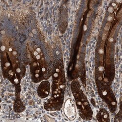 BAIAP2L1 Antibody, Novus Biologicals 25 &mu;L; Unlabeled:Antibodies, Polyclonal