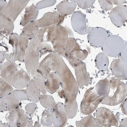 BAIAP2L1 Antibody, Novus Biologicals 25 &mu;L; Unlabeled:Antibodies, Polyclonal